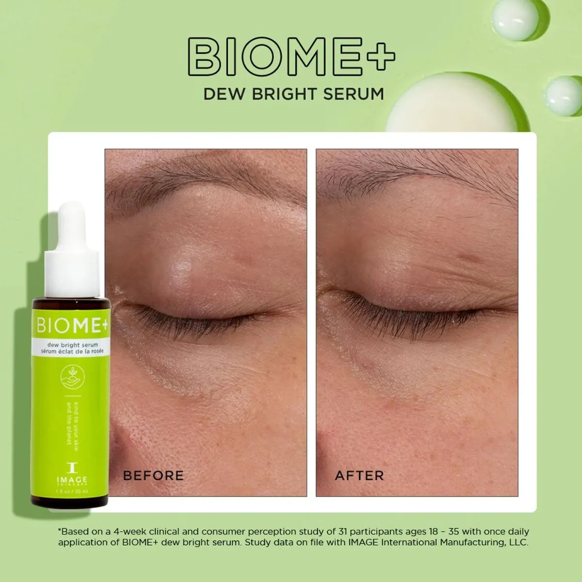 Image Skincare | BIOME  Dew Bright Serum 30ml